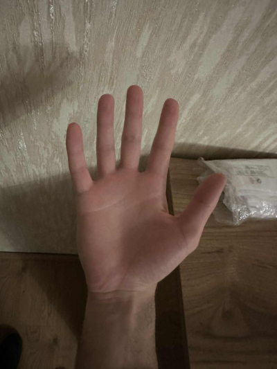 დაზიანებული ფოტოების აღდგენა